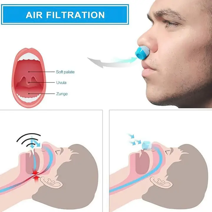 In 1 Anti Snoring And Air Purifier Nose Clip Anti Snoring Device (1 Pc With Plastic Case)