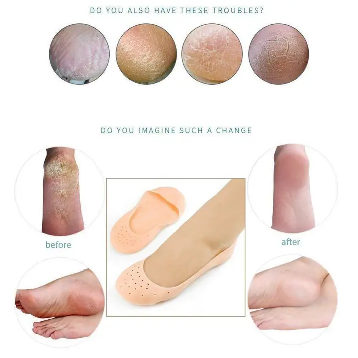 Anti Crack Silicone Gel Foot Protector Moisturizing Socks